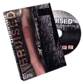 Bruised by Daniel Martin